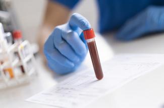 Picture of antibody blood test in a vial